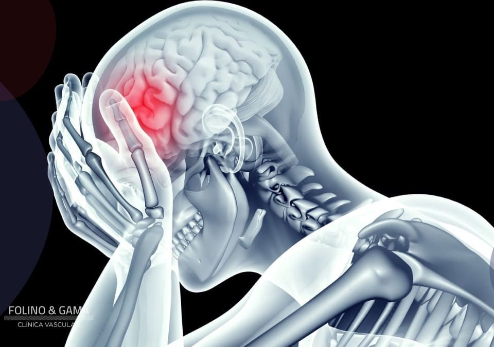 Trombose Venosa Cerebral