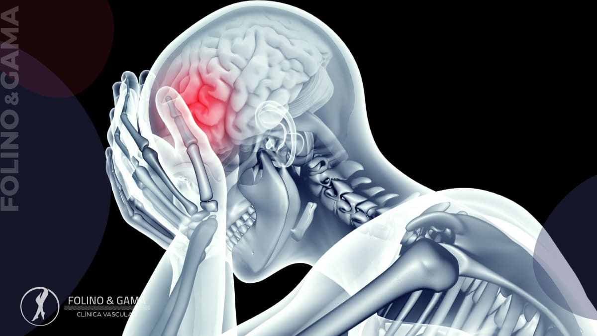 Trombose Venosa Cerebral