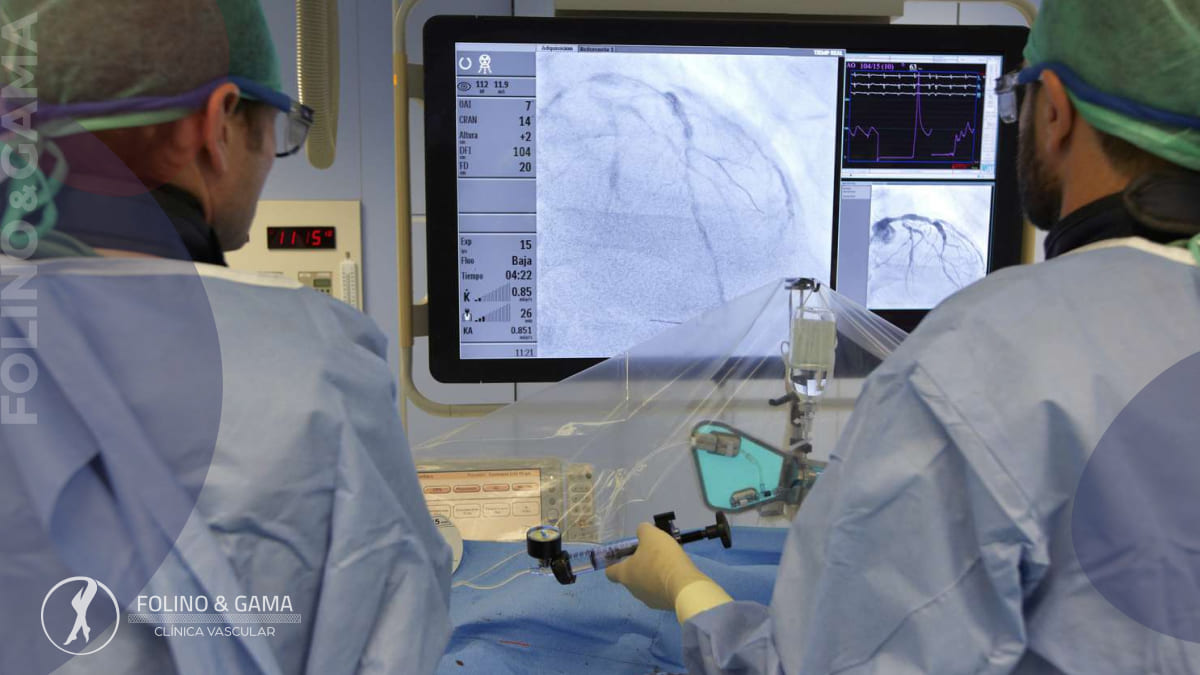 Angioplastia Dos Membros Inferiores